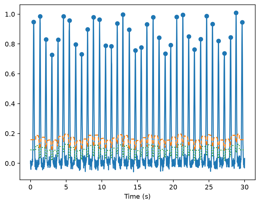 PPG waveform with detected pulse peaks